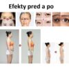 LiftiWave Mini: Kompaktní RF zařízení pro redukci vrásek a celulitidy - Image 4