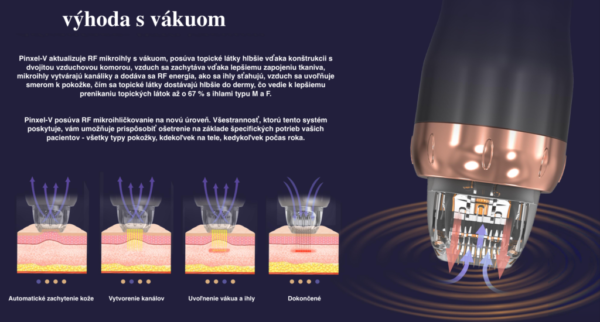 PINXEL-V - FRF / FRMN / MICRONEEDLE RF - Image 3